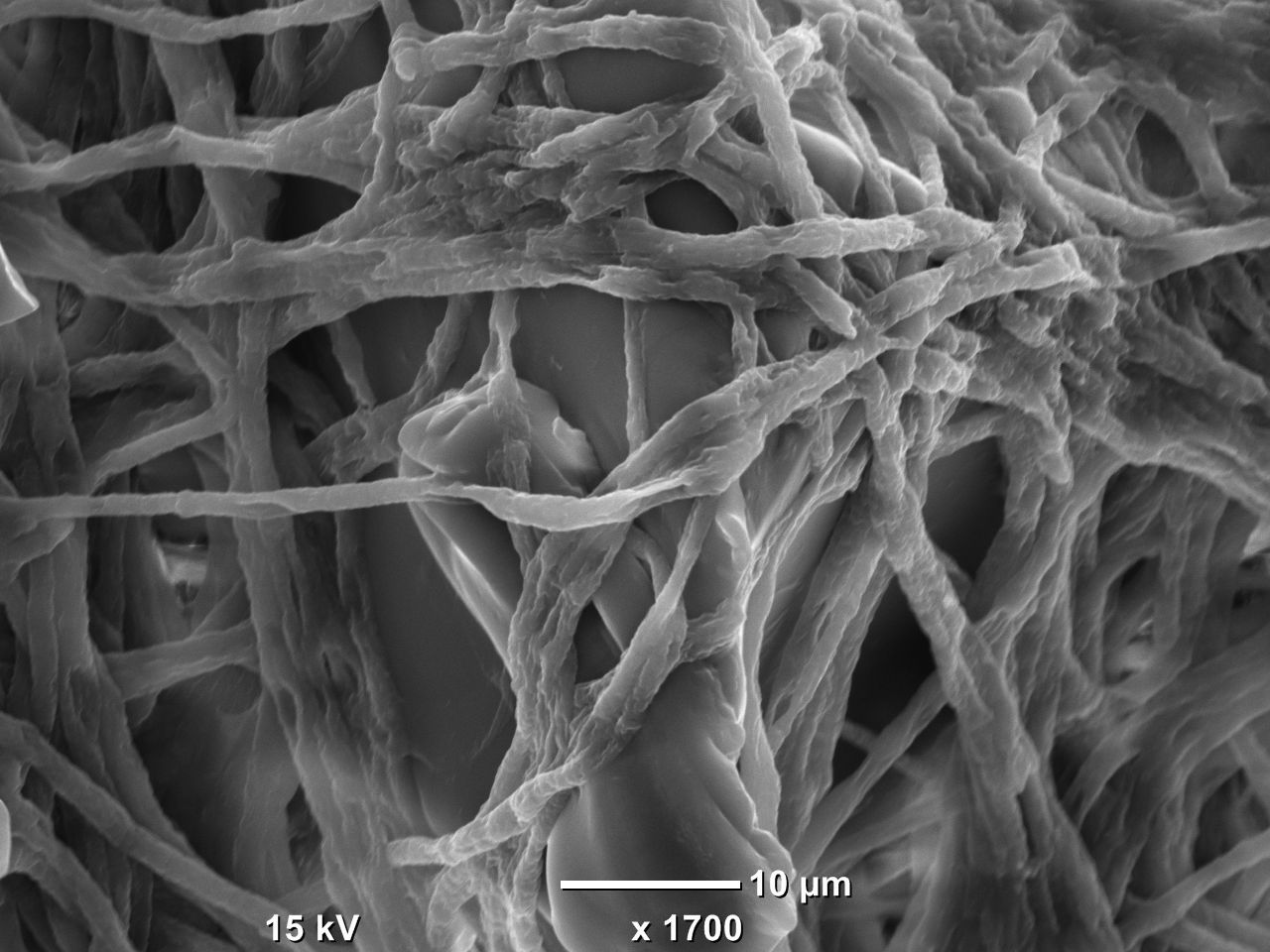 Elektronenmikroskopische Aufnahme von Fusarium auf einem Kunststoffpartikel. Fusarium ist ein Pilz, der Kunststoffpolymere abbauen kann. Bild: Sabreen Samuel Ibrahim Dawoud, IGB
