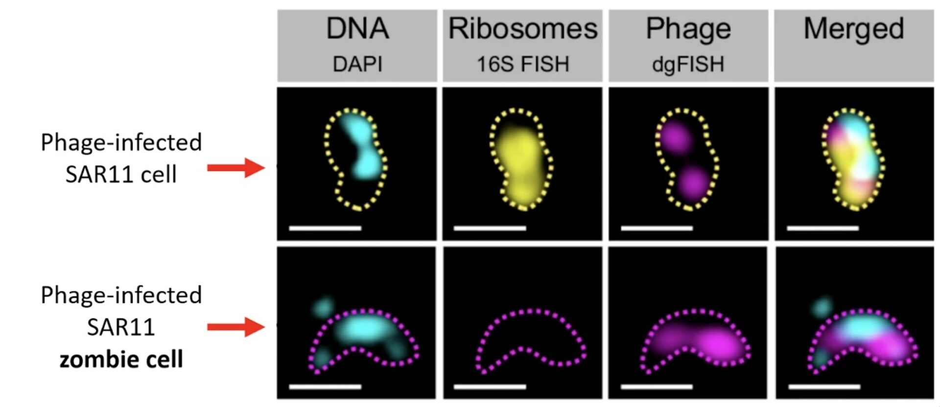 Unter dem Mikroskop erkennen Wissenschaftler SAR11-Zombie-Zellen daran, dass sie keine Ribosomen mehr haben. Ribosomen (gelb markiert) sind die „Proteinfabriken“ der Zellen, ohne diese befinden sich die Bakterien in einem Übergangszustand zwischen Leben und Tod (untere Reihe). Bild: Jan Brüwer, Max-Planck-Institut für Marine Mikrobiologie