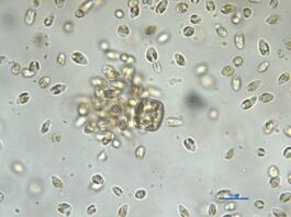 Schwarm der Mikroalge Prymnesium. 2022 sorgten die Gifte dieser winzigen Goldalge für ein großes Fischsterben in der Oder. Bild: Karla Münzner, IGB