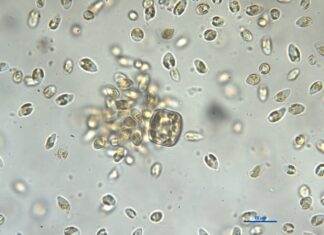 Schwarm der Mikroalge Prymnesium. 2022 sorgten die Gifte dieser winzigen Goldalge für ein großes Fischsterben in der Oder. Bild: Karla Münzner, IGB